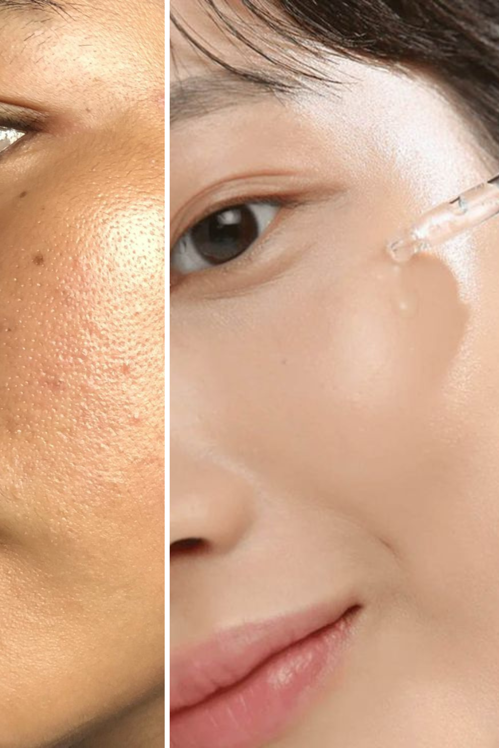 alpha arbutin is a potent yet gentle skin-brightening agent suitable for various skin types and concerns, offering a safer alternative to more aggressive treatments